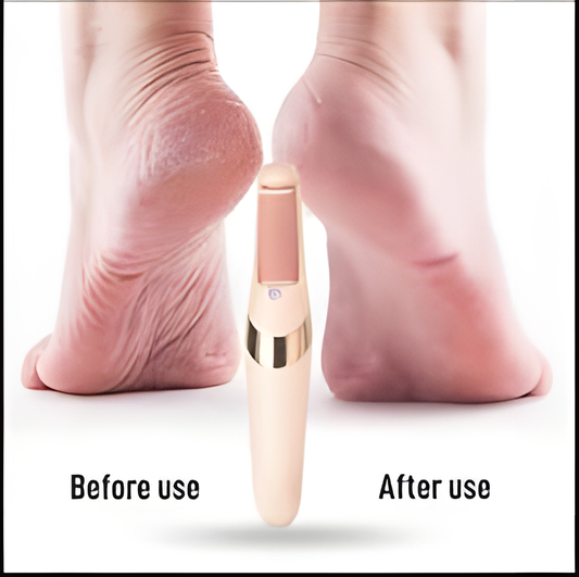 Electric Foot Callus Remover Tool – Electronic File for Dead Skin & Hard Tissue
