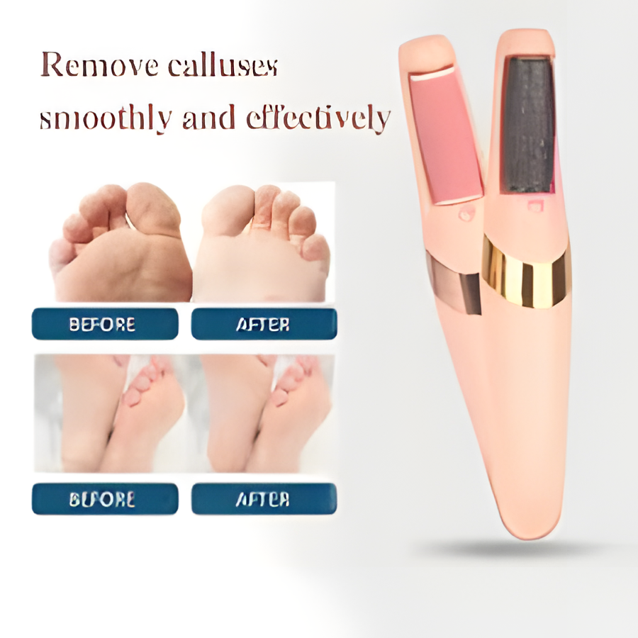 Electric Foot Callus Remover Tool – Electronic File for Dead Skin & Hard Tissue