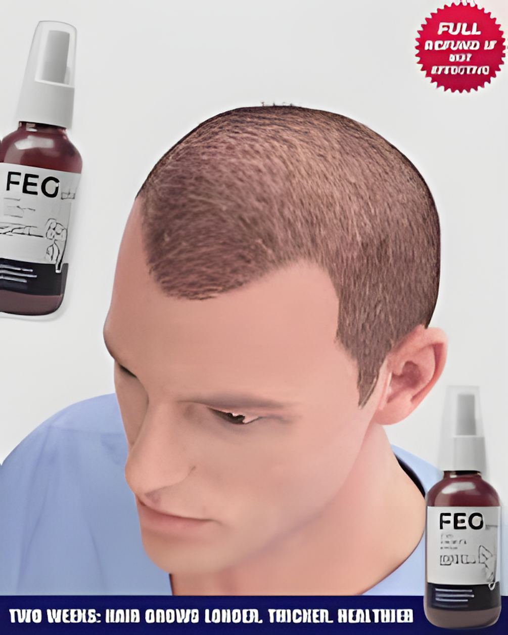 FEG Plus Hair Growth Spray – Fast Regrowth & Anti Hair Fall Treatment
