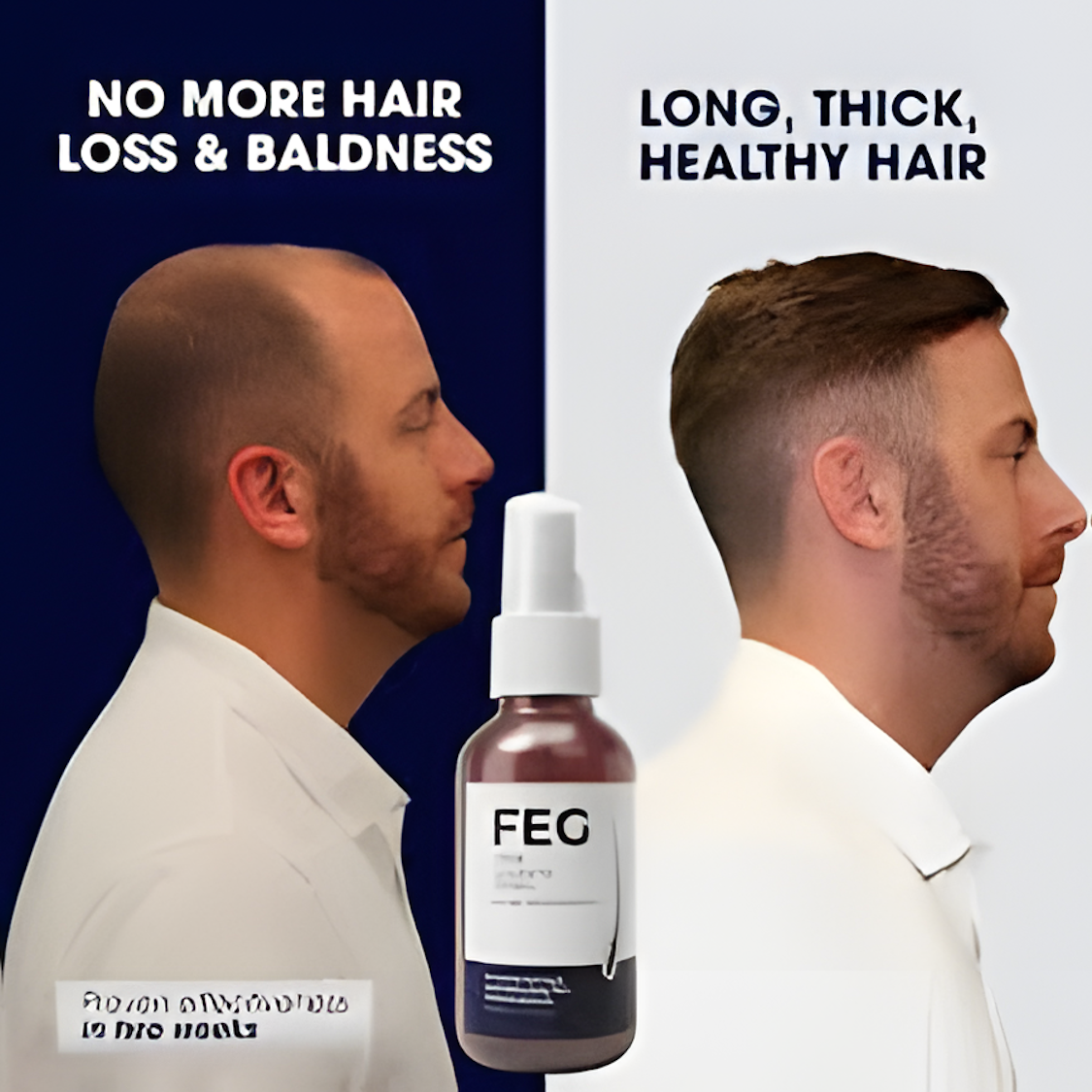 FEG Plus Hair Growth Spray – Fast Regrowth & Anti Hair Fall Treatment